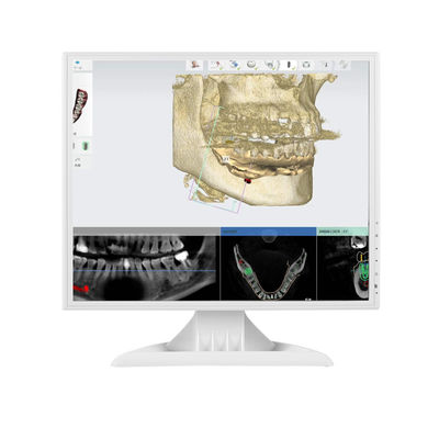 75mm HDMI VGA 17 inch màn hình máy tính LED 4:3 Square PC Monitor